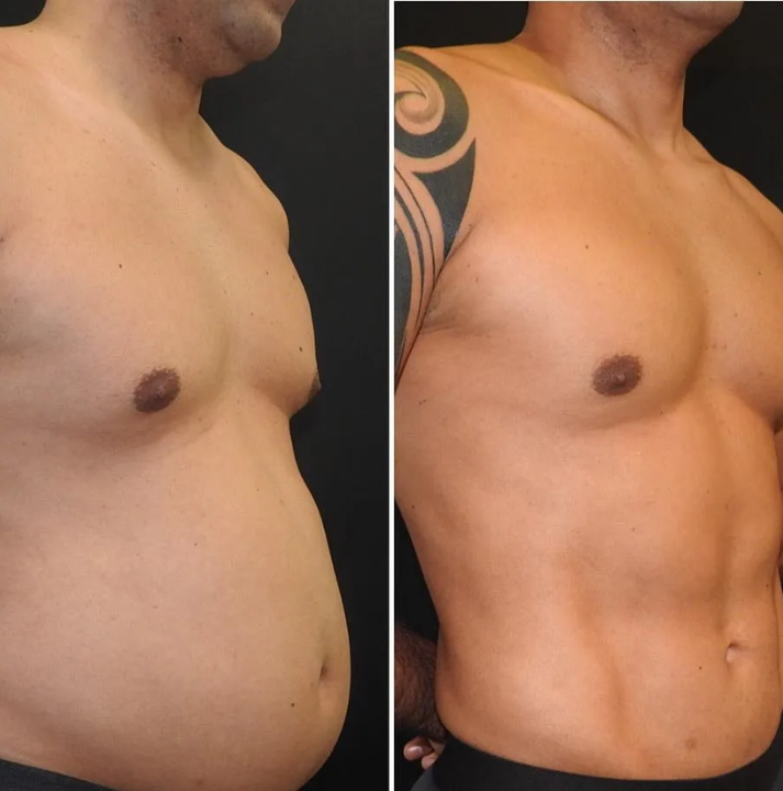 SIBIOTIK®: Adiós Barriga. Consigue un vientre plano de Forma Rápida y Efectiva